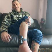 AGONY: Carl Lloyd is struggling to walk because of the EMS electronic ankle tag which he says is much too tight
