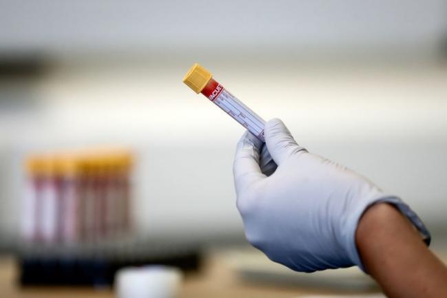 Blood tests are being rationed  by the NHS (Image: Simon Dawson/PA Wire)