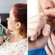 Whooping cough (pertussis), also known as the 100-day cough, is a bacterial infection of the lungs and breathing tubes, according to the NHS