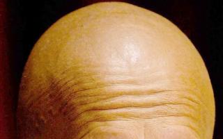 Calling man bald is sexual harassment, panel of 'balding' judges rule. (PA)